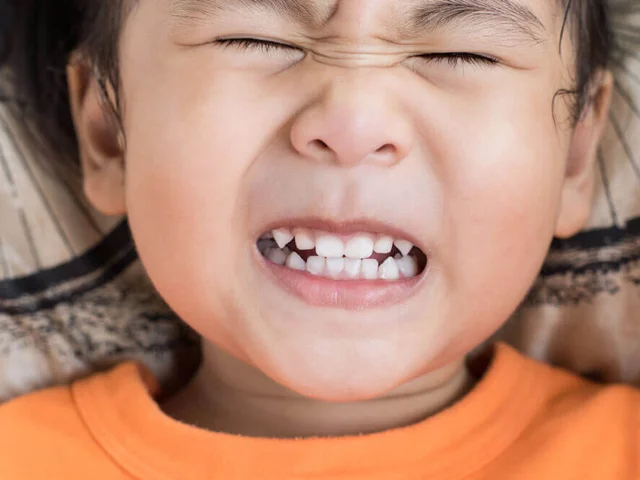 آسیب‌های ناشی از ضربه به دندان شیری در کودکان